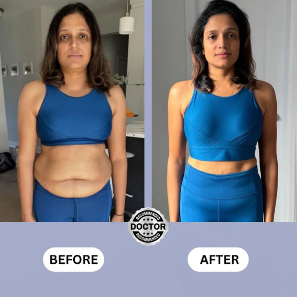 Upyogaa Vibration Plate | Fitness Platform Exercise Machine | Vibrating Lymphatic Drainage Shaking | Full Body Shaker Workout Vibrate Stand Shake Board | Sport Gym for Weight Loss Fat Burner for Women Men| 1 Year Warranty