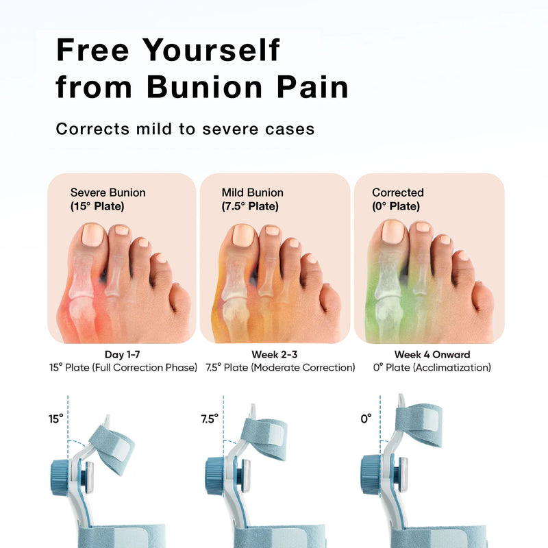 Upyogaa Bunion Corrector for Women Men | 1 year warranty
