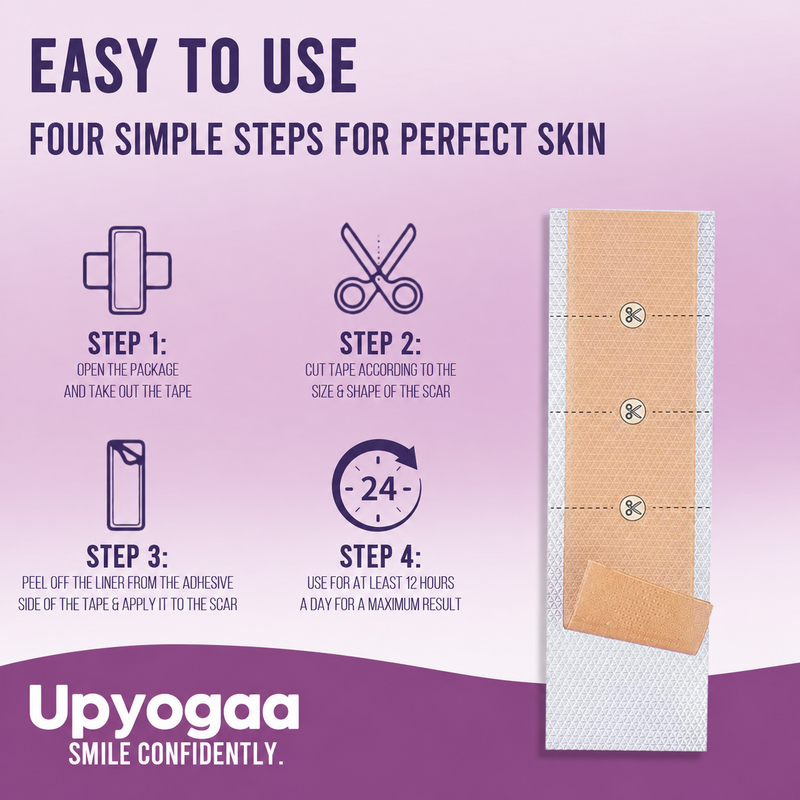 Upyogaa Medical-Grade Silicone Scar Tape Roll for C-Section, Surgical, Keloid, Burn & Acne Scars, Breathable, Gentle on Skin, Cut-to-Size, 4 cm × 150 cm| 1 Year Warranty