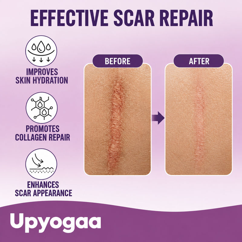 Upyogaa Medical-Grade Silicone Scar Tape Roll for C-Section, Surgical, Keloid, Burn & Acne Scars, Breathable, Gentle on Skin, Cut-to-Size, 4 cm × 150 cm| 1 Year Warranty