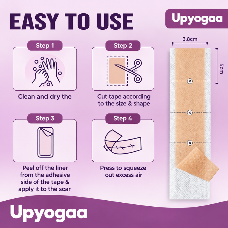 Upyogaa Medical-Grade Silicone Scar Tape Roll for C-Section, Surgical, Keloid, Burn & Acne Scars, Breathable, Gentle on Skin, Cut-to-Size, 4 cm × 150 cm| 1 Year Warranty
