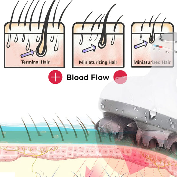 Electric Scalp Massager | Hair Growth | Deep Massage | Rechargeable